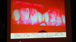 2018年8月21日　スタディグループ火曜会例会