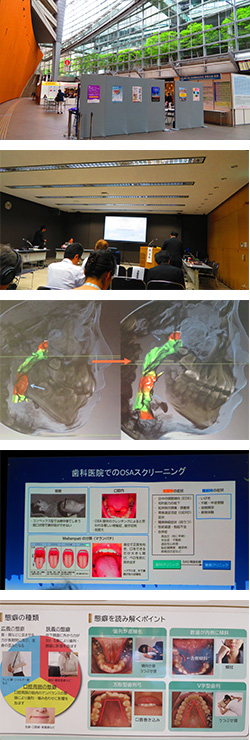 2019年6月23日　日本顎咬合学会学術大会2日目