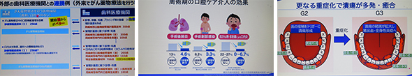 2025年7月31日　がん患者の口腔マネジメントwebセミナー