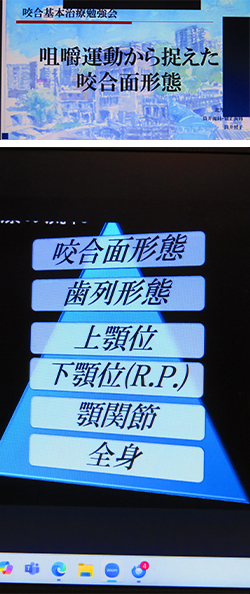 2025年9月22日　咬合治療勉強会