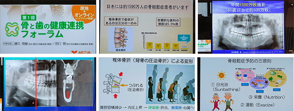 2025年10月19日 骨と歯の健康連携フォーラム