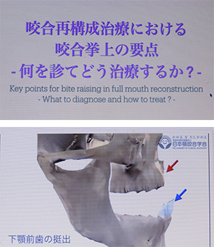 2026年2月1日　顎咬合学会Web研修会〔2〕