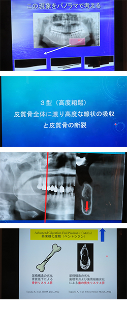 2026年2月22日　IOCiLWebセミナー
