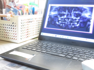 2026年2月26日　小児矯正研究会症例検討会