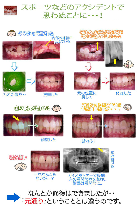 アクシデントで思わぬことに…