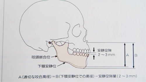 咬合 高 径 と は